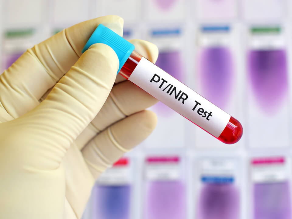 PT/INR Blood Clotting Test